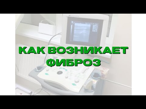 Почему Боль в спине НЕ проходит или Как возникает МИОФИБРОЗ?