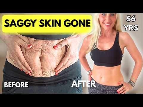 Saggy Belly Skin GONE at 56 | How I Tightened It Naturally