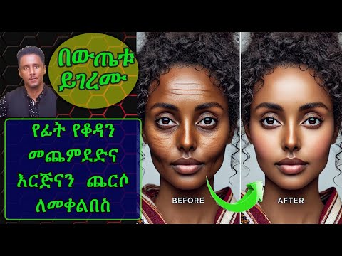 ETHIOPIA | የፊት የቆዳን መጨምደድ/እርጅናን ጨርሶ ለመቀልበስ | ይህንን መጠቀም የግድ ነው
