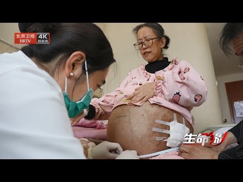 2025最新|担心人财两空不愿手术,顶着巨大腹部生活15年,眼看着妈妈生命流逝,女儿崩溃了【生命缘第15季】