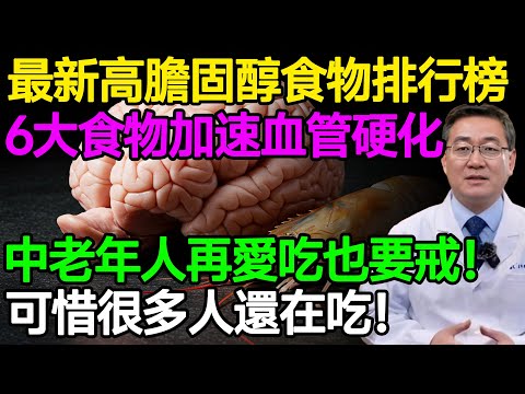 最新高膽固醇食物排行榜,6大食物加速血管硬化,中老年人再愛也要戒!可惜很多人還在吃!#樂享養生 #健康知識 #老年健康