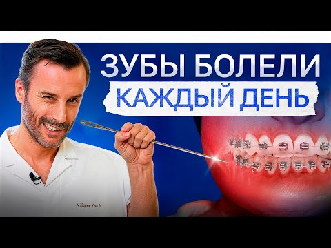 Первый месяц после установки брекетов. То еще испытание!