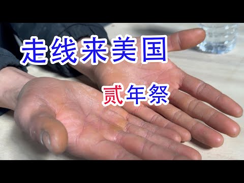 河北小伙走线来美两周年后过的怎么样?