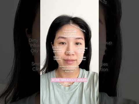 What your breakouts are telling you!! π’π’ A GUIDE