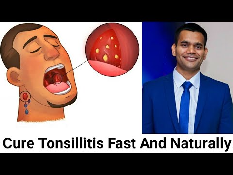 How To Cure Tonsillitis Fast And Naturally /Powerful Home Remedies For Tonsil Stones That Works Fast