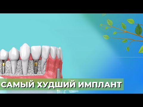 Какие имплантаты не советуют☘️