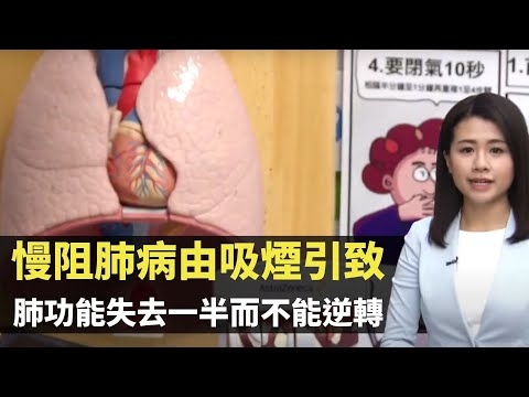慢阻肺病由吸煙引致 肺功能失去一半而不能逆轉 肺氣泡失彈性影響呼吸換氣- TVB最強生命線 - 香港新聞 - TVB News- 黃靖婷