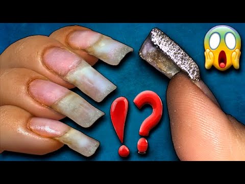 LEFT WITHOUT Nails! 😡 Half a YEAR WITHOUT Correction! ❄️ CRYSTAL NAILS. Nail extension with package