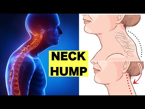 How to Fix a Neck Hump and Slim Face|can be done while sitting