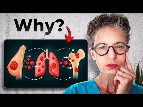 After Treatment: Why Breast Cancer Still Comes Back