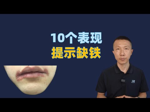 缺铁不只是贫血,还有9个表现你绝对不知道
