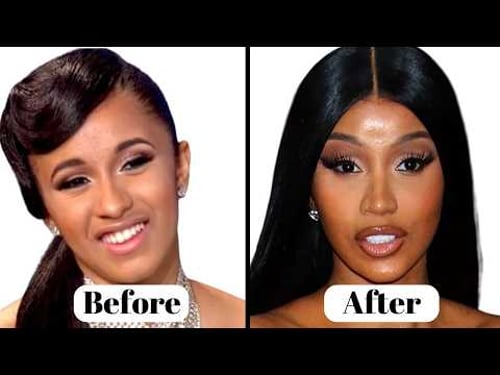 Cardi B’s Plastic Surgery Transformation | Before & After