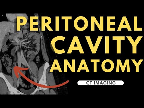 Peritoneal cavity, abdominal organs and spaces | Radiology anatomy part 1 prep | CT abdomen