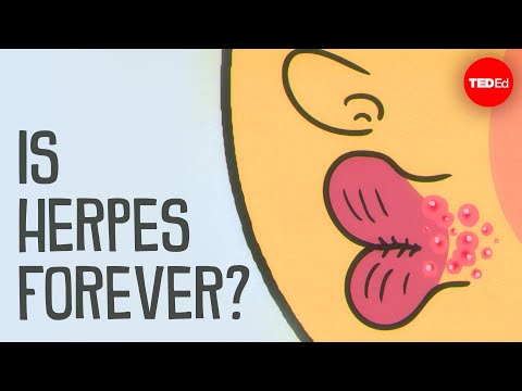 What causes herpes, and how can you treat it? - Christine Johnston