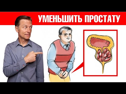 Аденома простаты👉как решить проблему с увеличенной простатой