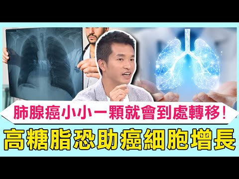 醫曝肺腺癌「小小一顆就會到處轉移」不好發現!現代人飲食「高糖+高脂」恐助癌細胞長不停...不抽菸也難避免?【醫師好辣】必看精彩片段