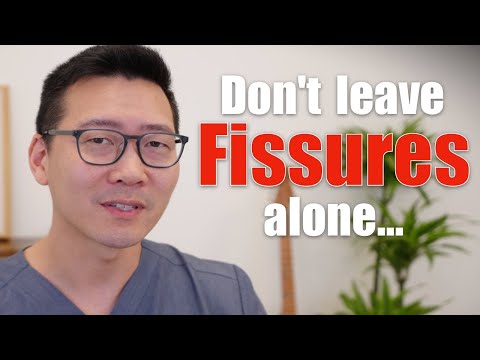 Don't Leave Anal Fissures Alone!