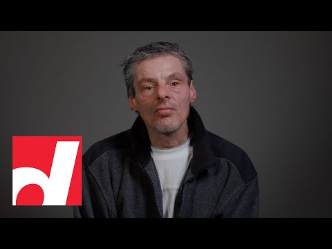 Homeless and alone in Toronto, he’s determined to get his old life back | Before & After