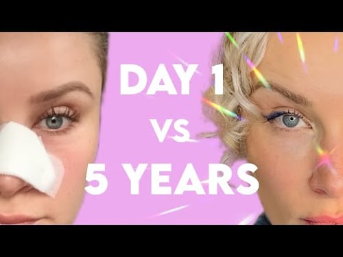 Recovery Timeline: Mohs Scar Healing on Face with Pictures and Helpful Tips ❤️🩹