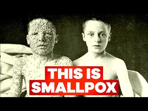 The Only Disease You Can't Catch