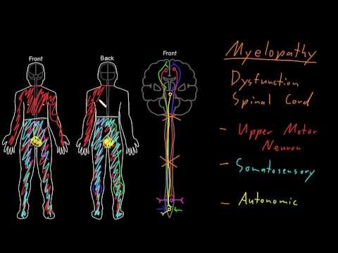 Syndrome: Myelopathy