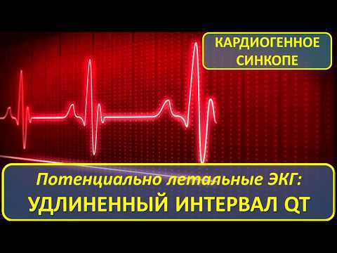 Синдром удлиненного QT и Полиморфная Желудочковая Тахикардия "Torsades de pointes"
