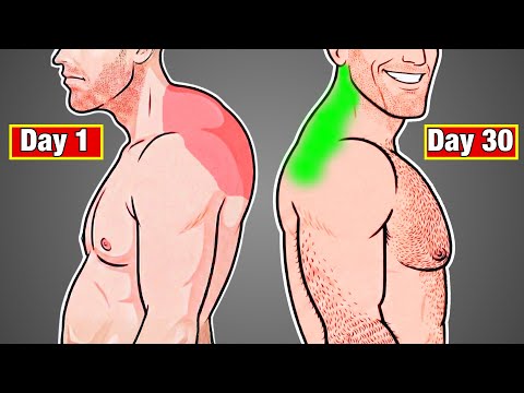 If You Have Terrible Posture Do This Exercise (Fix Your Hunchback)