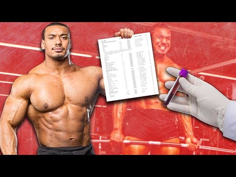 Reacting To Larry Wheels Blood Work