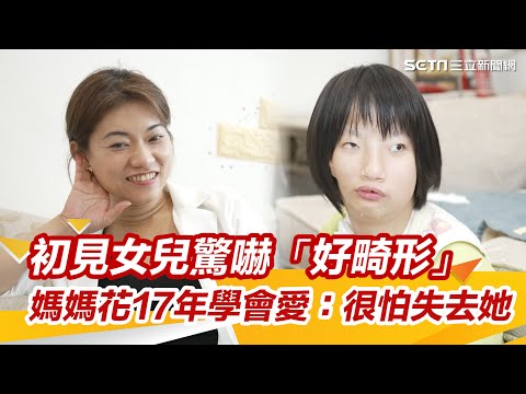 母愛非天生/初見女兒驚嚇「好畸形」 媽媽花17年學會愛:很怕失去她|@setn