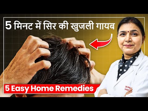 Itchy and Dry Scalp - TRY 5 Best Home Remedies Without Any Medicine | Dandruff, Hair Growth
