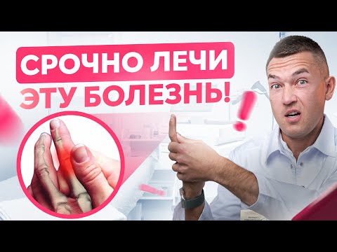 Щелкающий палец НУЖНО лечить! Что делать если пальцы не разгибаются? Болезнь Нотта