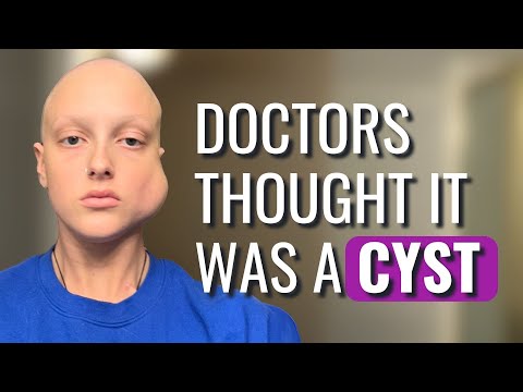 My Only Symptom Was A Sharp Lump On My Jaw - Brittany | Rare Sarcoma | The Patient Story