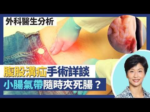 腹股溝疝手術|疝氣帶小腸氣帶隨時夾壞腸?微創手術vs開刀手術比較!術後注意事項:多水多纖維!|王建芳醫生 外科醫生楊丕祥醫生|人類健康研究所