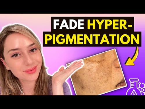 Top 10 Ingredients to Fade Hyperpigmentation | Dr. Shereene Idriss