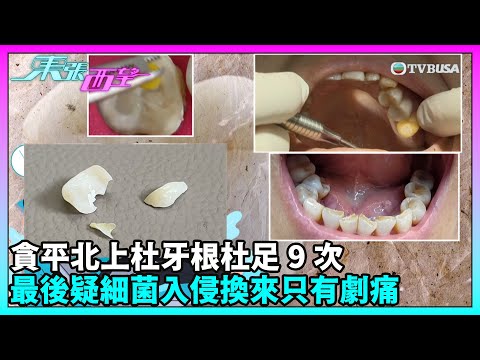 東張西望|港人北上深圳睇牙科接受九次杜牙根治療後痛楚難忍,求退款遭惡言相向!本港牙醫揭示錯誤程序|TVBUSA|民生