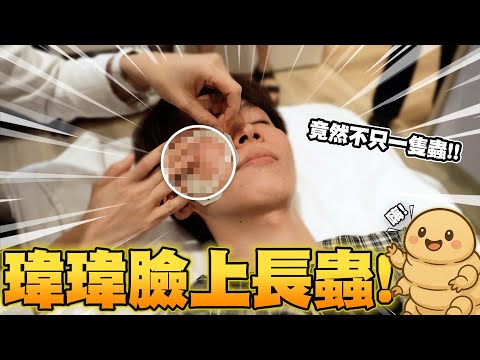 臉上長蟲🐛帶員工去驗蟲,誰的臉是蟲王?結果讓大家都不敢相信!【黃氏兄弟】Ft. @tars5469 青春痘暨玫瑰斑協會