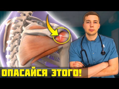 Боль В Плече - Импиджмент-синдром! Это ОПАСНЕЕ, чем ты думаешь...