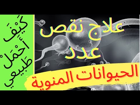 الحلقة (17) نقص عدد الحيوانات المنوية, الأسباب والتشخيص والعلاج