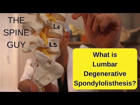 What is Lumbar Degenerative Spondylolisthesis - Part 1