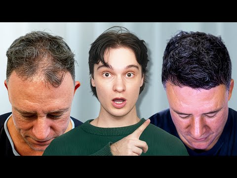 Prevent, Stop & Reverse Hair Loss Before It’s Too Late! (Science Based)