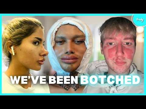 We Regret Our Botched Plastic Surgeries | HOOKED ON THE LOOK