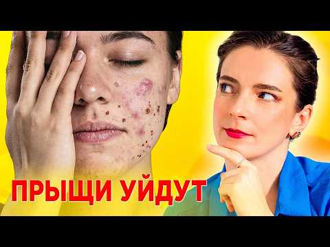 ACNE? YOUR SKIN WILL BEGIN TO RECOVER ITSELF! Find out what you need for HEALTHY and CLEAR SKIN!