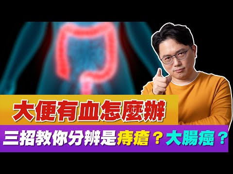 大便有血怎麼辦 !? 3招分辨 痔瘡 大腸癌【江P醫件事#86】