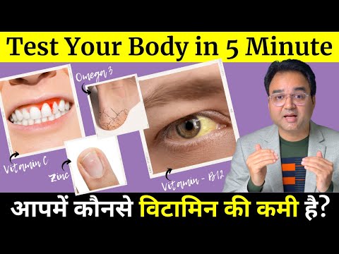 5 मिनट में पहचानें आपके शरीर में कौनसे विटामिन की कमी है ? | Signs of Nutritional Deficiency