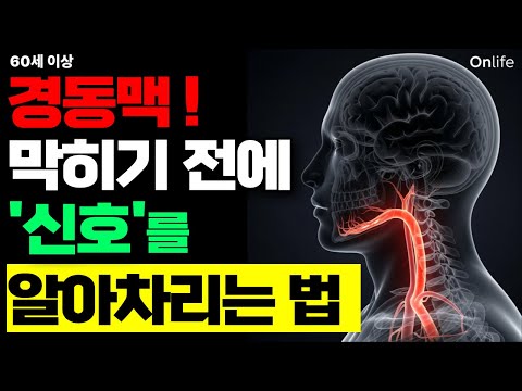 경동맥 막히기 전 ‘3가지 신호’ 지금 확인하세요