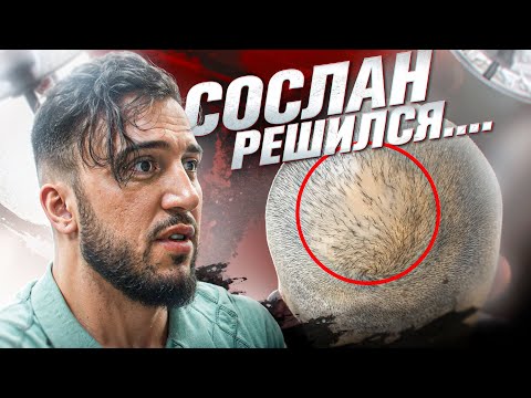 ВЛАДЕЛЕЦ КЛИНИКИ БУДЕТ ДЕЛАТЬ ПЕРЕСАДКУ ВОЛОС...