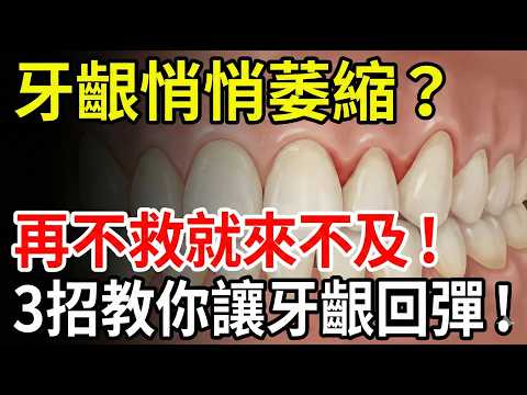 Are your gums receding? Doctors urgently warn: It will be too late if you don't act now! 3 tips...