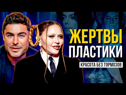 ЖЕРТВЫ ПЛАСТИКИ. 17 ЗВЕЗД, КТО НЕ СМОГ ОСТАНОВИТЬСЯ ВОВРЕМЯ