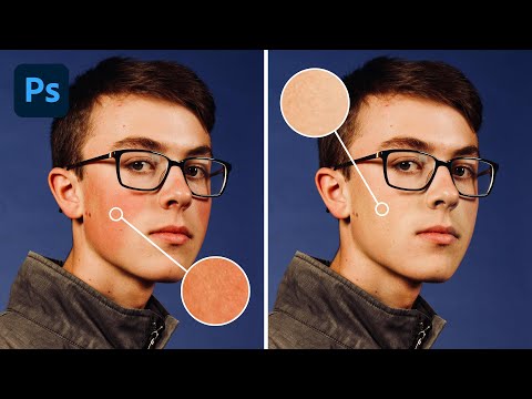How to Remove Redness from Skin in Photoshop