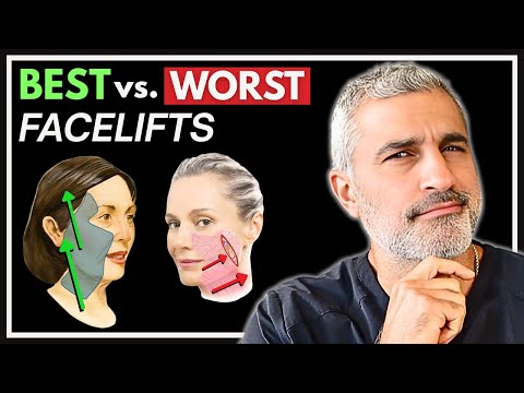 8 Facelifts Ranked from WORST to BEST! Plastic Surgeon Explains
